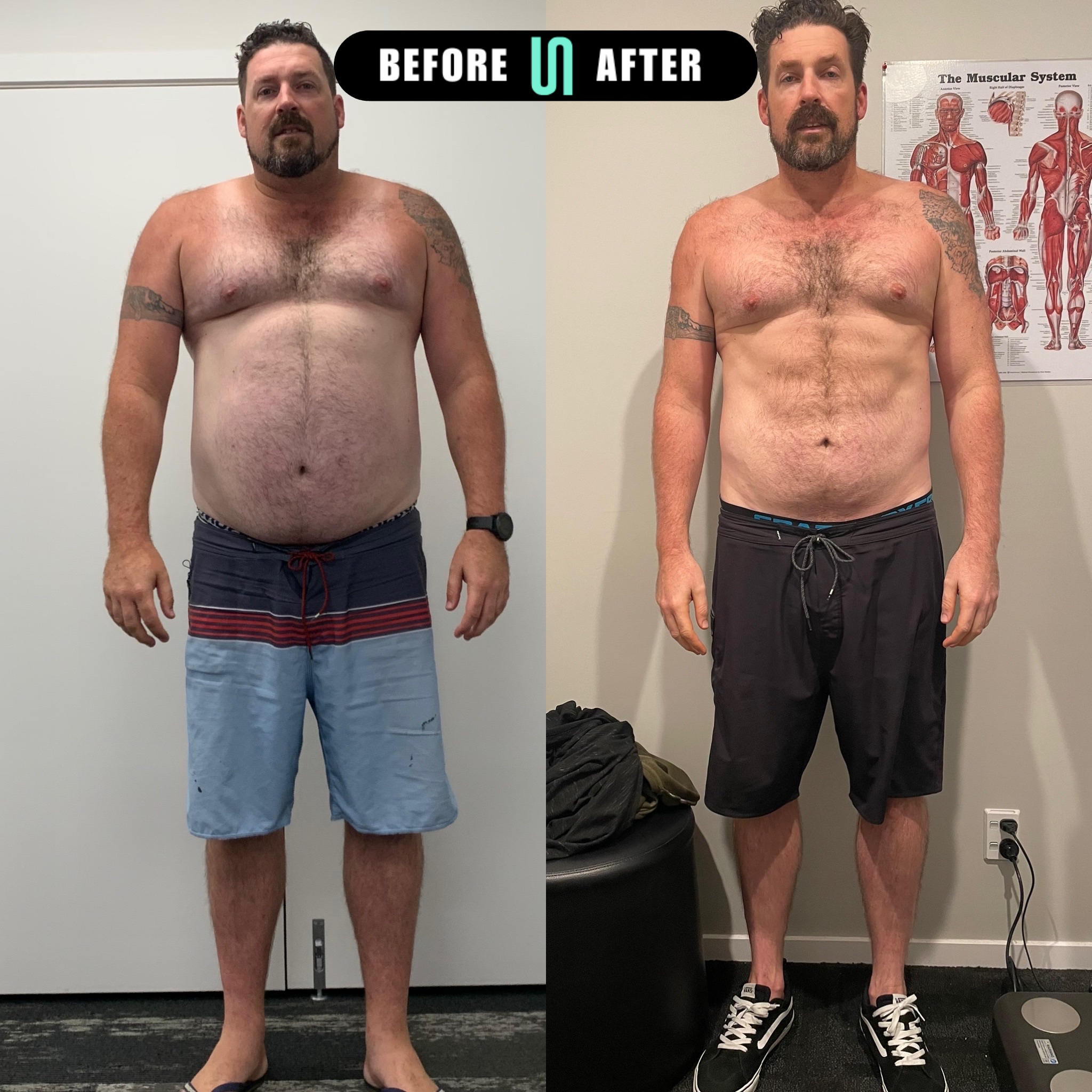 Younited member before and after